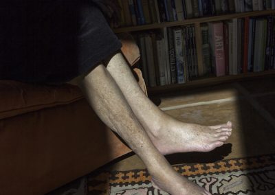 Marna Clarke, Igg's Legs